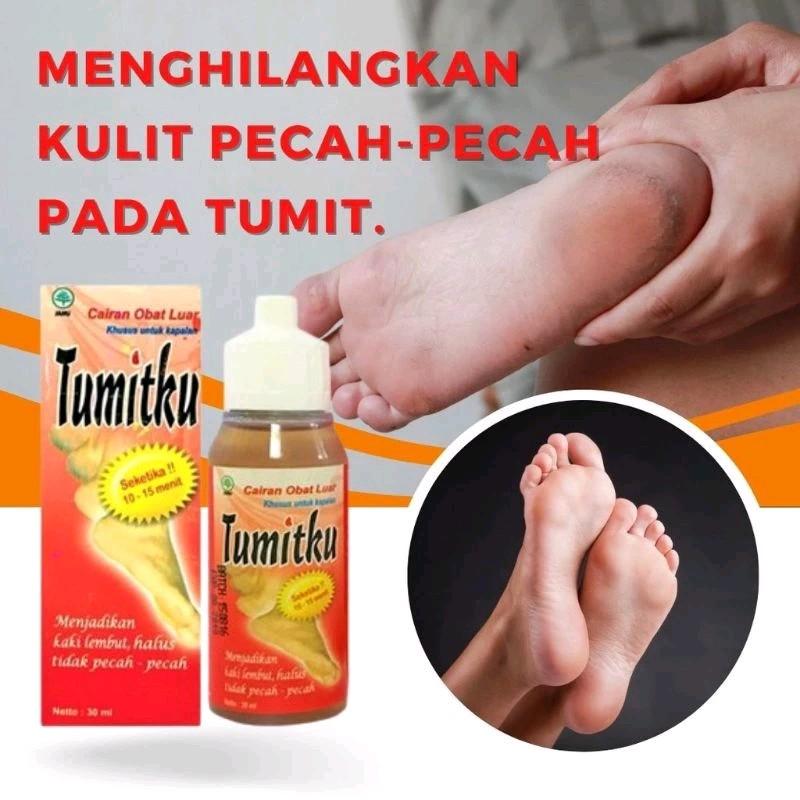 TUMITKU / TUMIT KU UNTUK KAKI PECAH PECAH 0