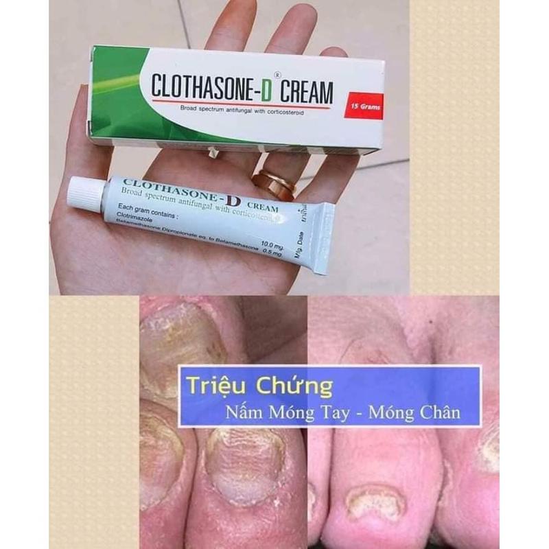 Kem Bôi Nấm Móng Tay Móng Chân CLOTHASONE-D CREAM 15g Thái Lan 15g