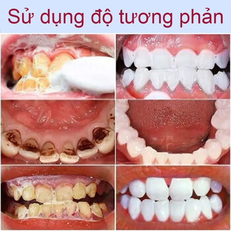 Gel nano bạc GAOLIBAI đánh bật cao răng sạch mảng bám trắng răng cho hơi thở thơm mát, GAOLIBAI chính hãng 120g 6
