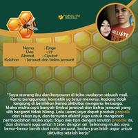 Gambar Propolis SM untuk Atasi Bruntusan di Wajah Jerawat Pasir Bekas Jerawat,  Perawatan Muka - Isi 6ml - 1 dari Apotek Herbal Kota Administrasi Jakarta Barat 3 Tokopedia