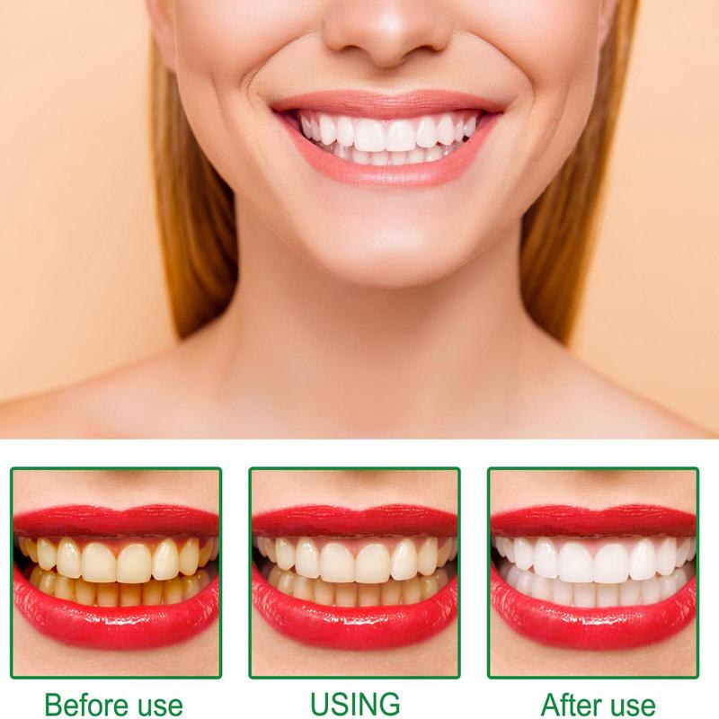 Bút Làm Trắng Răng, Gel Đánh Răng, Loại Bỏ Vết Bẩn, Vệ Sinh Răng Miệng, Sử Dụng Tại Nhà, Bút Làm Trắng Răng, Loại Bỏ Mùi Hôi Răng Miệng, Dụng Cụ Chăm Sóc 1