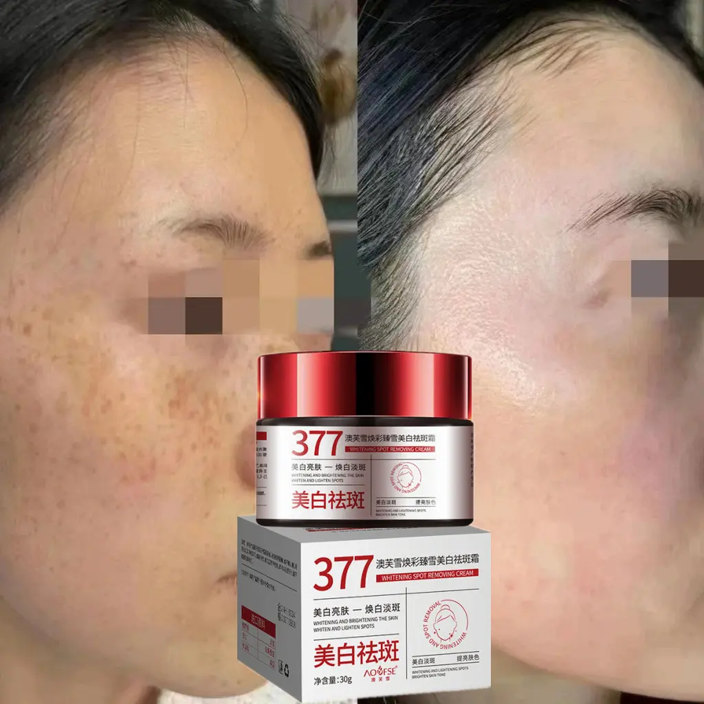 377 Whitening Spot Removing Cream Lighten Pigmentation Dark Spots Whiten Skin 30g