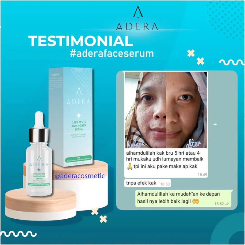 [ BISA COD ] SERUM PENGHILANG FLEK/SERUM WAJAH PENGHILANG JERAWAT/Serum Adera wajah glowing flek hitam/ SERUM WAHITENIG TERBAIK DALAM 3 HARI/SERUM PENGHILANG FLEK/SERUM WAJAH GLOWING BPOM ORIGINAL Adera Anti Acne Serum Original BPOM  Lapak_Cantik87 5