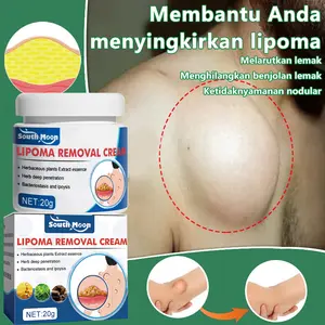 Krim Perbaikan Benjolan Lemak, Benjolan Keras, Benjolan Subkutan, Lipoma, Salep Benjolan, Krim Penghapus Lipoma, Secara Khusus Menghilangkan Beberapa Benjolan Subkutan Tunggal, Krim Benjolan Kulit / Obat Benjolan Efektif