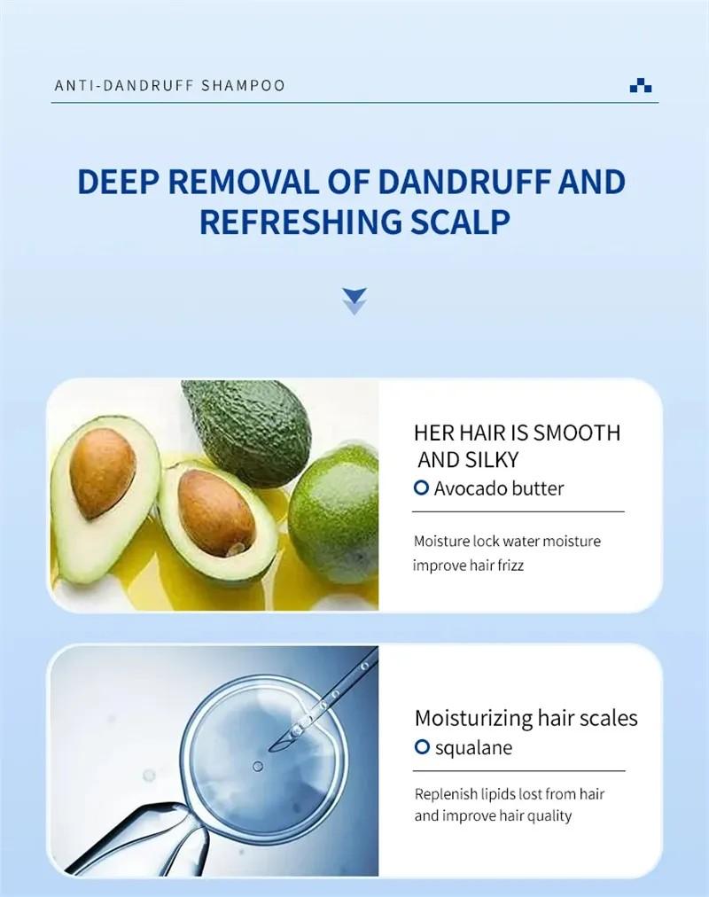 Sampo Ketombe 300ml untuk psoriasis, pereda gatal akibat selenium disulfida, sampo anti ketombe, pengontrol minyak