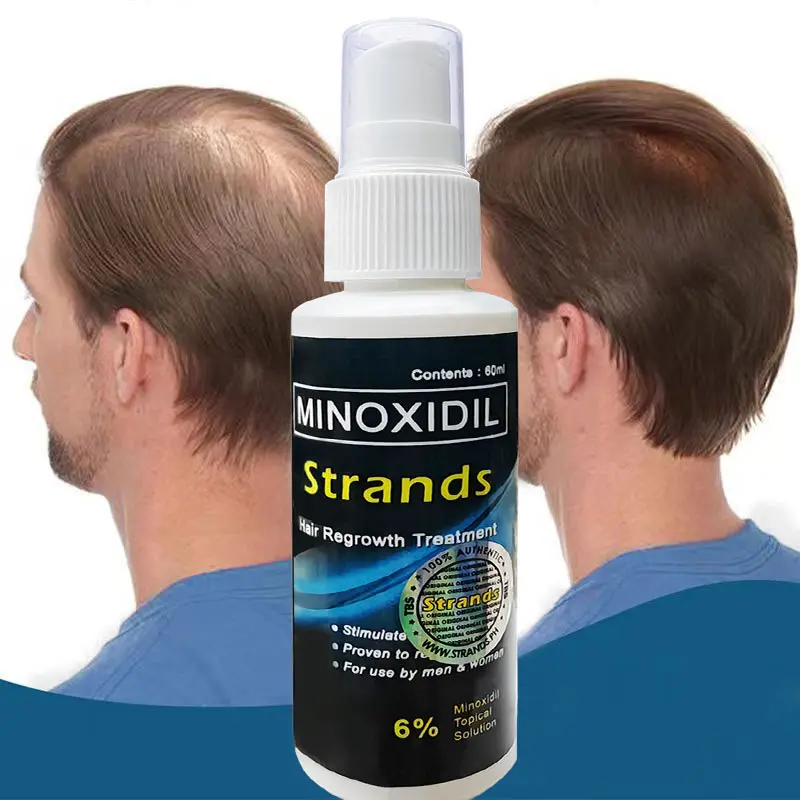 Chất điều trị rụng tóc, Strands Minoxidil 6%, mọc tóc, mọc râu, dung dịch tại chỗ