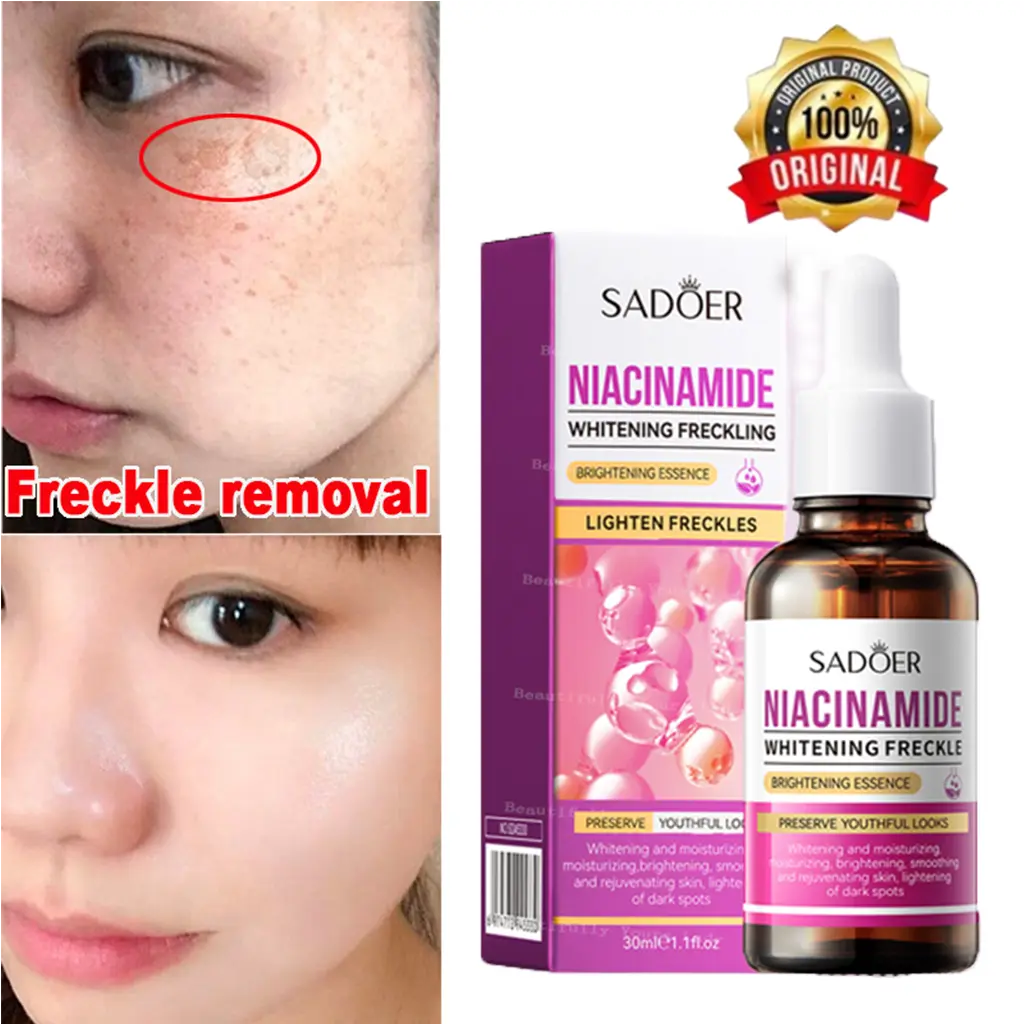 Niacinamide Whitening Freckle Serum Remover Melasma Serum Freckle Whitening