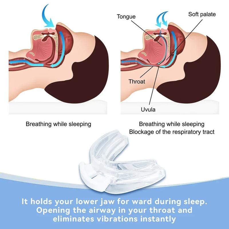 Product Introduction of Anti Snoring Bruxism Mouth Guard Portable Corrective Breathing Positioning Teeth Retainer Sleep Prevention Snoring Health Care 6