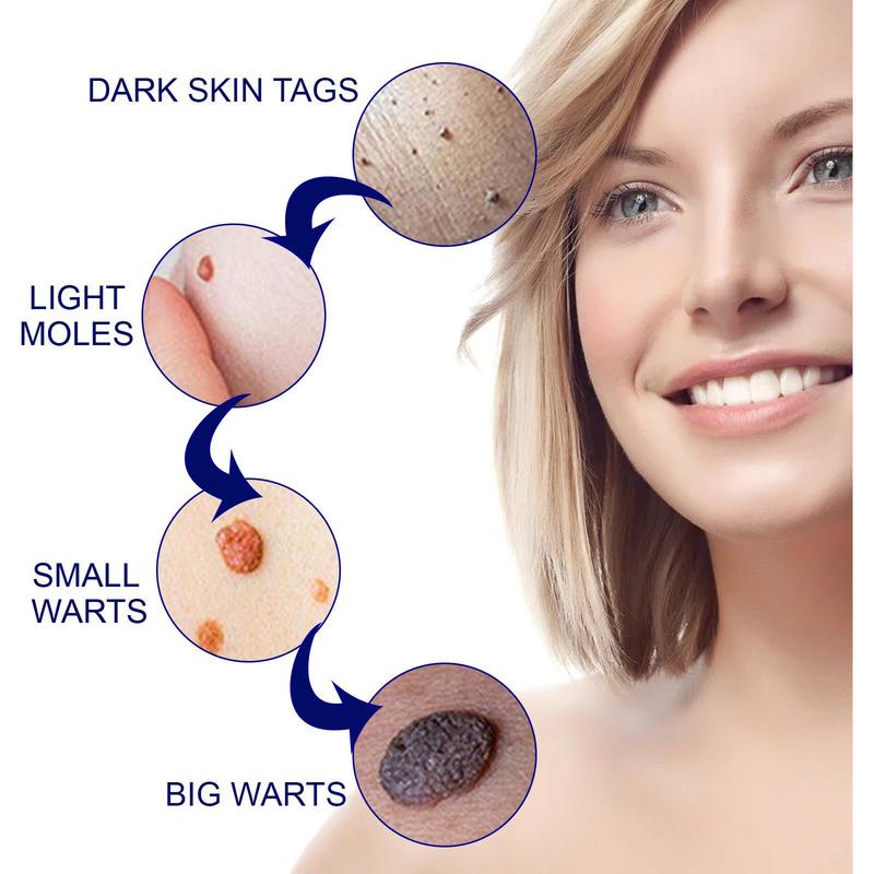 Natural Herbal Ingredients Wart Cream, 2 Counts Moisture Cream, Smoothes and Brightens Skin, Skin Care Product for Men and Women 4