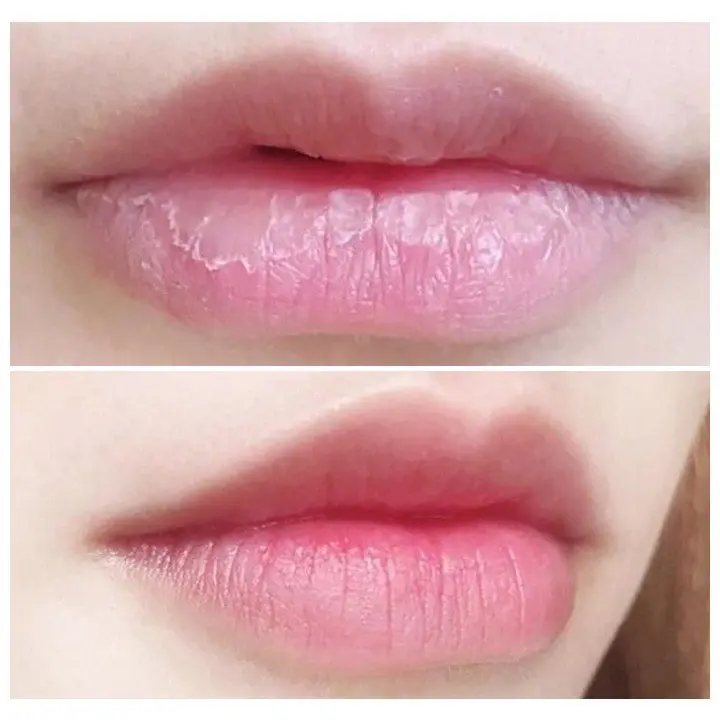 Dưỡng môi Collagen giảm thâm, kích màu môi sau phun xăm, dưỡng môi căng bóng, mềm mượt hũ 5g 4