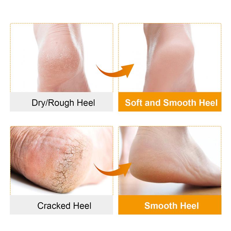 Product Introduction of Soft Silicone Gel Socks For Professional Foot Skin Care Protector Relieve Dry Cracked Peeling Heels Shoes Insole Pedicure Tools 23