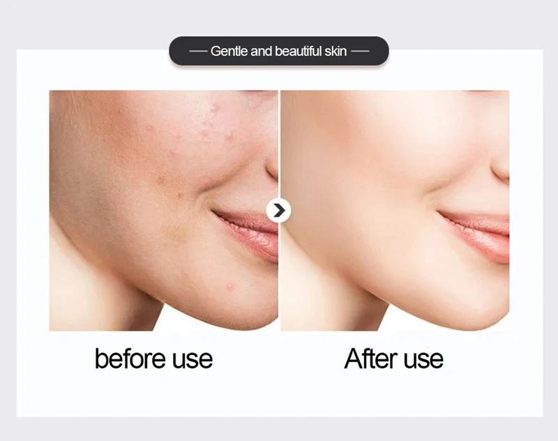 Product Introduction of 500ml  Large Capacity Essence Water Niacinamide Improve Dull Hyaluronic Acid Moisturize Dry Skin Facial Beauty Care Toner 9