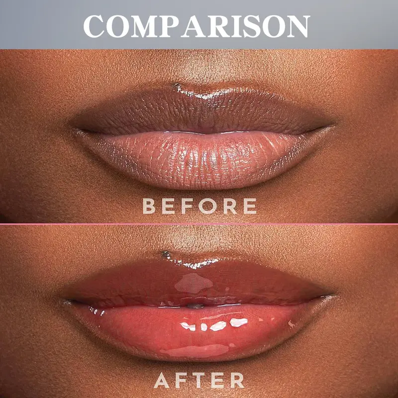 Moisturizing Lip Balm, Natural Turmeric Lip Balm, Hydrating Lip Treatment For Women & Girls 5