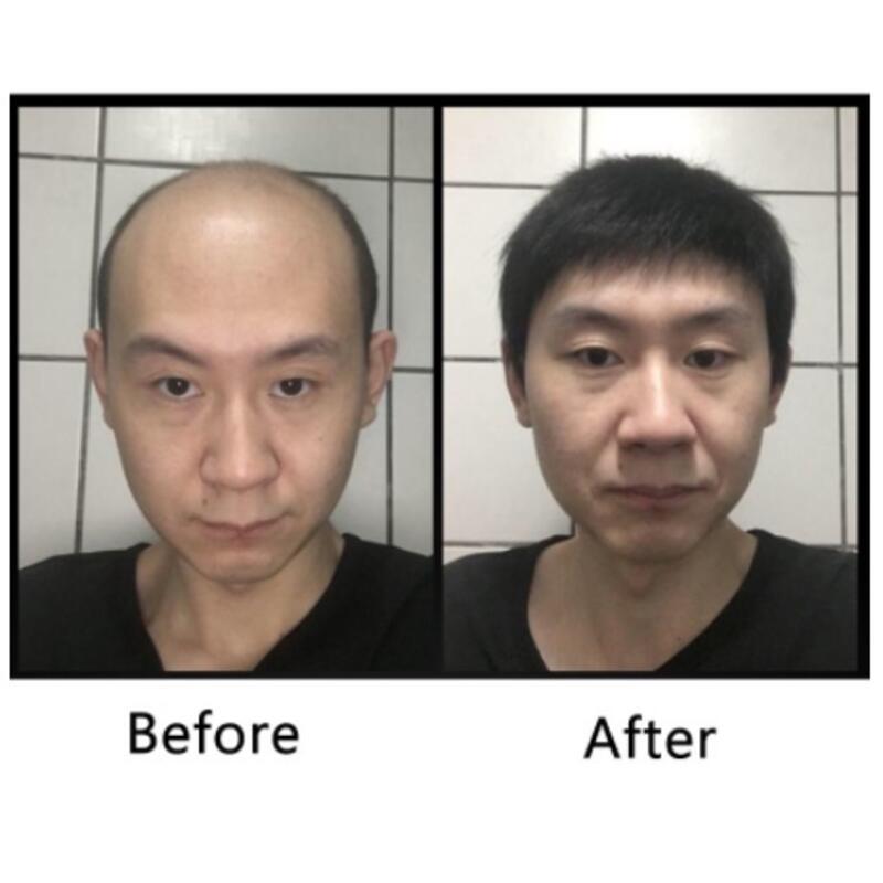 Product Introduction of High end men's wigs, real hair, fake to fake。Short Handsome Korean Style Wig Hairpiece Breathable Forehead Replacement Cover White Hair And Baldness 2