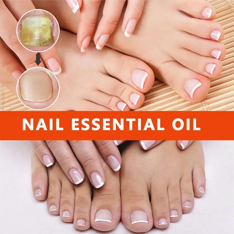 Tinh Dầu Chăm Sóc Móng, Hoa Oải Hương, 10ml, H9Q1, Để Chăm Sóc Móng 6