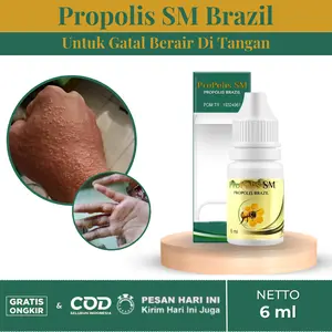 Propolis SM Cairan Penghilang Gatal Berair Di Tangan Isi 6 ml Foot Bau