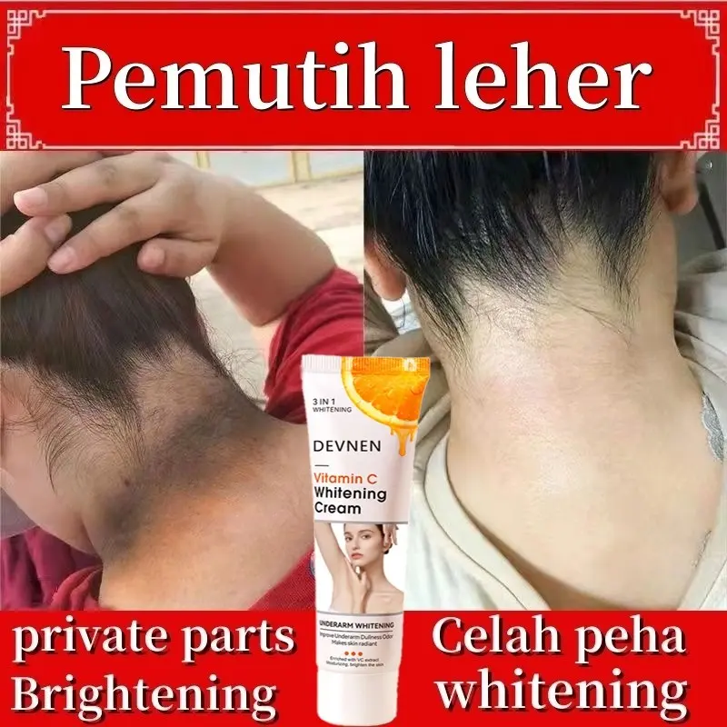 Krim Pemutih ketiak 50gr Vitamin C Underarm Private Parts Whitening Cream Miss V Mencerahkan Selangkangan 2