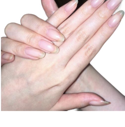 [LK007] Combo 5 Serum Nấm Móng Dùng Cho Móng Tay Và Chân, Do Làm nails sơn gell thường xuyên 4