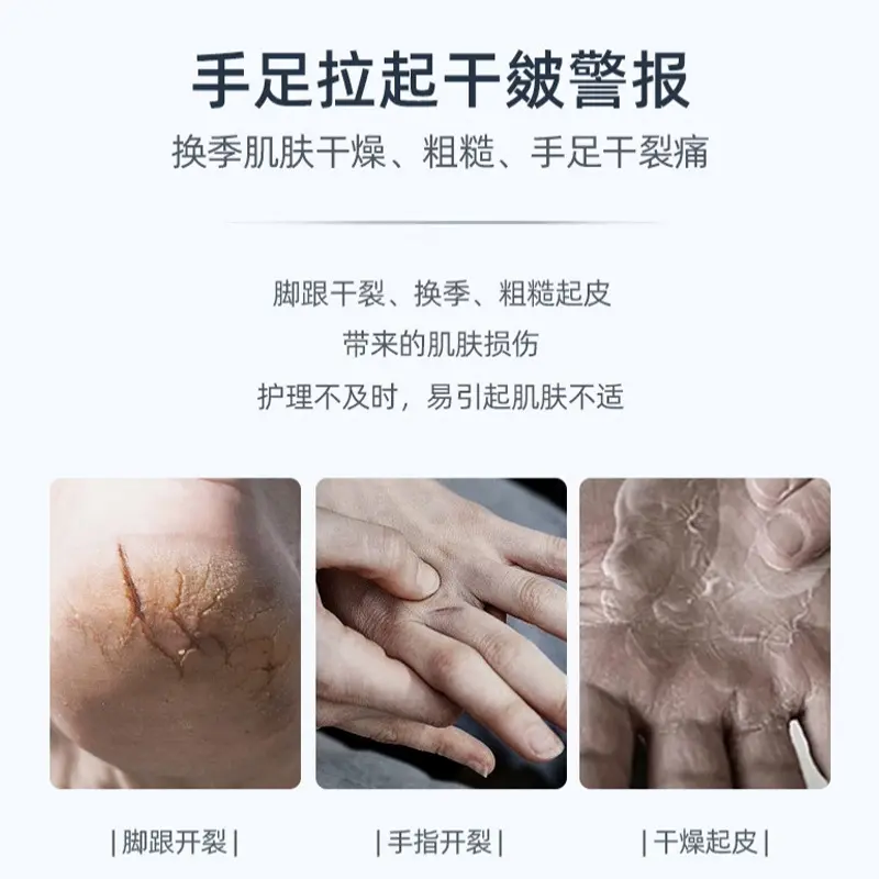Miếng Dán Vết Chàm, Dành Cho Ngón Tay Và Chân, Miếng Dán Gót Vết Chống Nứt Da, Thoáng Khí, Đóng Gói Độc Lập, Sử Dụng Cho Tay Và Chân 3