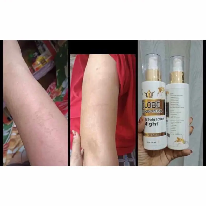 HB klobe Platinum & Collagen ORIGINAL 100% [KEMASAN BARU] 6