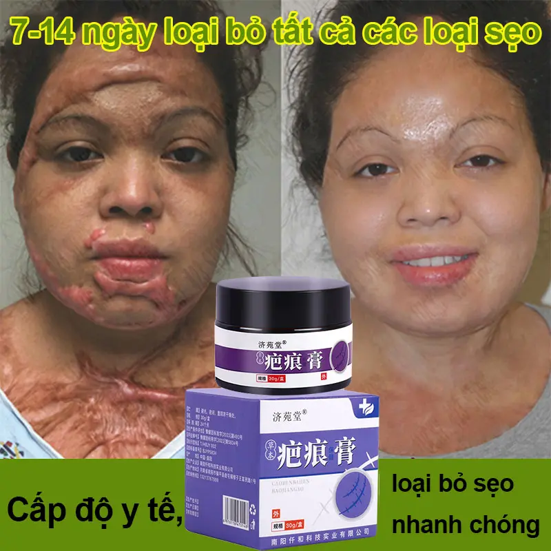 [Weekly prompt scars removal] acne scars removal cream skin whitening scars repair cream diluting various scars such as surgical scars treatment dark scars repair skin scratch 30g