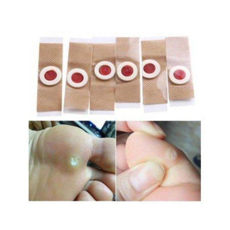 [COD]CORN PLASTER REMOVER 6Pcs Corn remover skin tag remover - TikTok ...