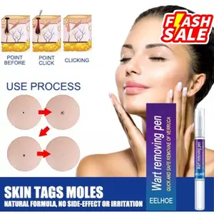 [Scar Removal] Serum Tahi Lalat Kutil Ampuh EELHOE Tag & Wart Remover Pen Cream , SkinCare ScarCare Kering Tubuh Wajah Lotion Muka Memudarkan Menyembuhkan Hitam Perawatan