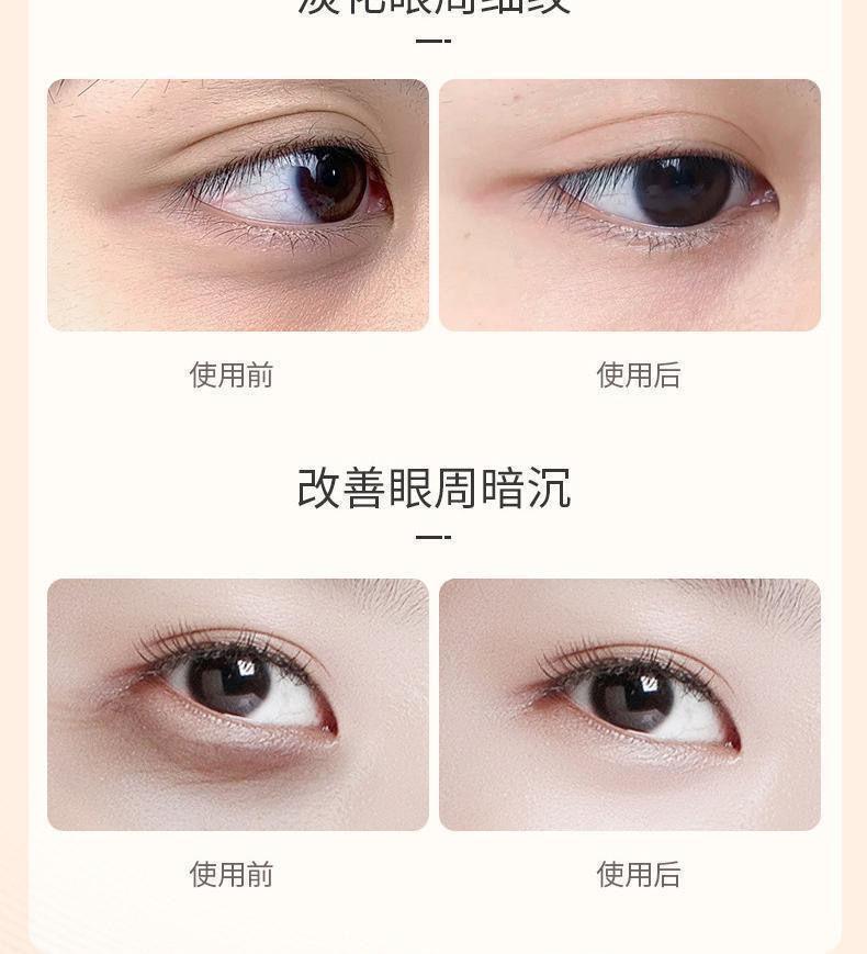 Product Introduction of Authentic lutein eye serum with lifting and firming rollerball for reducing dark circles and fine lines, brightening the eye area 5