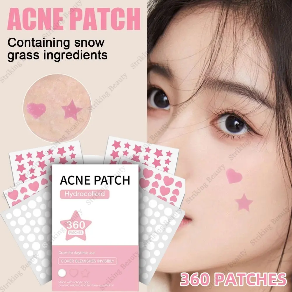 600pcs/360pcs/300pcs Acne Patches Effective Acne Removal Inflammatory And Sedative Waterproof Acne Patches Facial Skin Care