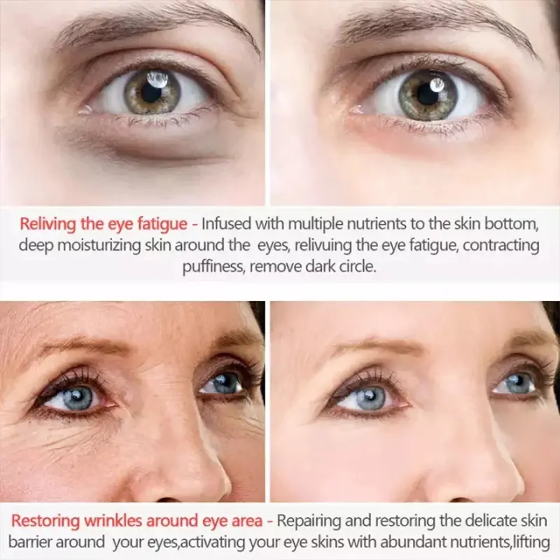 Kem mắt, Wrinkle, Kem loại bỏ túi mắt, Kem loại bỏ túi và quầng thâm, Loại bỏ túi mắt, Gel chống Bọng Mắt, Trì hoãn lão hóa, làm mờ nếp nhăn, Làm săn chắc, Làm sáng da, Unisex, Giảm quầng thâm, Thích hợp cho túi mắt, ys013 1