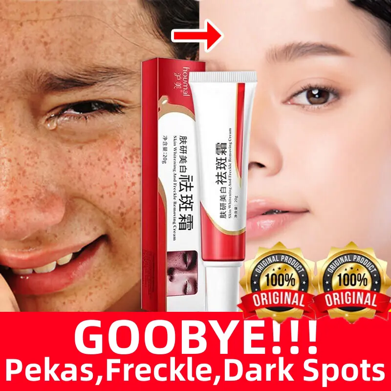 Kem Trị Tàn Nhang Làm Trắng, Hiệu Quả, 20g, Dành Cho Mọi Loại Da, Thuốc Mỡ Làm Trắng, Thuốc Mỡ Trị Mụn, Loại Bỏ Nám Và Vết Thâm Đen, Dưỡng Ẩm, Qban001