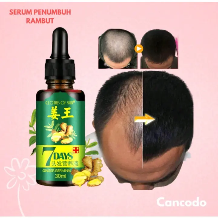 ️️BIG SALE️ ️ORI [PENUMBUH RAMBUT BOTAK] Essence Anti Rontok / Botak Asli Obat Uban Penghitam Penyubur Original 4