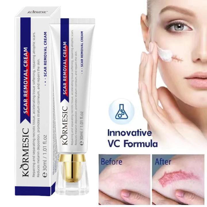KORMESIC Kem Dưỡng Ẩm Giảm Sẹo Vết Thâm Đen Làm Sáng Da Dưỡng Ẩm 24 Giờ Mới…