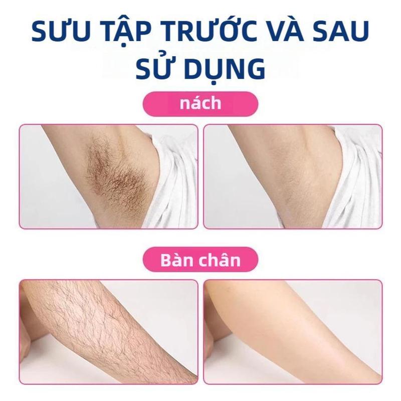 [SIÊU DÍNH] 20 Miếng Wax Lông Không Đau - 3 Giây Đánh Bay Lông Tay Chân 4