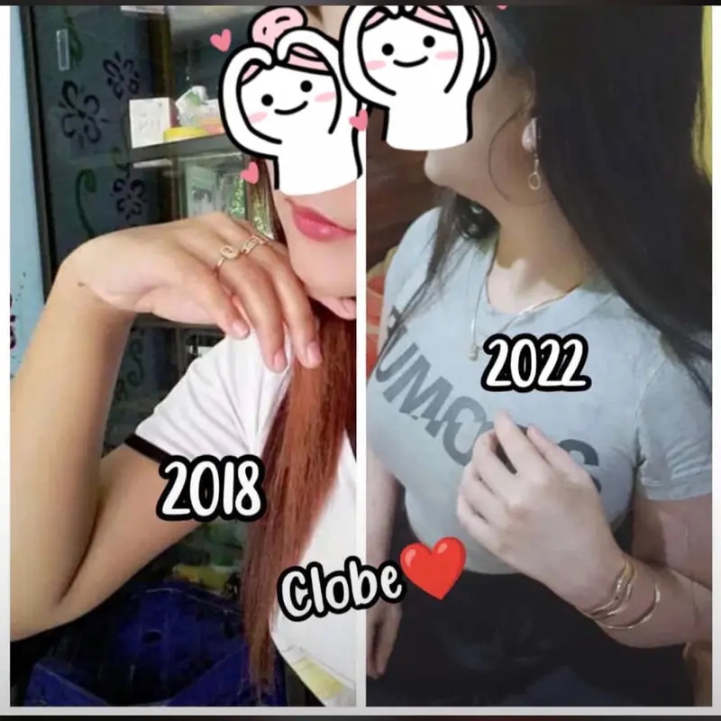 HB klobe Platinum & Collagen ORIGINAL 100% [KEMASAN BARU] 5