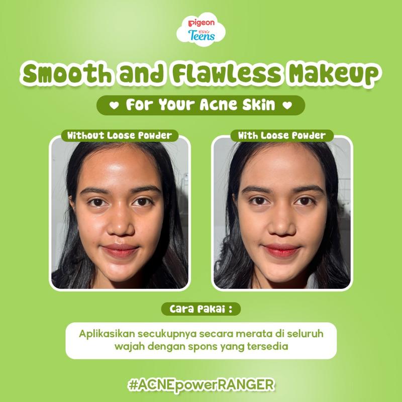 PIGEON TEENS - Loose Powder Bedak Tabur Bedak Remaja Squalane|Acne Ranger|Bright Heroes 5