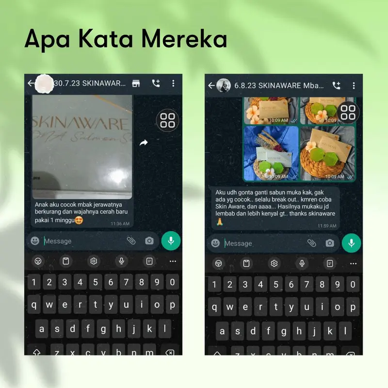 SKINAWARE Sabun Flek Hitam Membandel 100gr [BPOM] 1