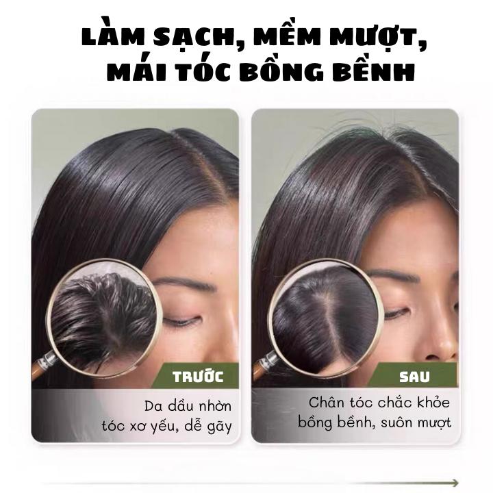 Product Introduction of Dầu gội đầu tinh chất thiên nhiên giúp làm sạch mềm mượt tóc Chăm Sóc Tóc, daugoidau, dầu gội đầu sạch gầu, giảm rụng tóc 0