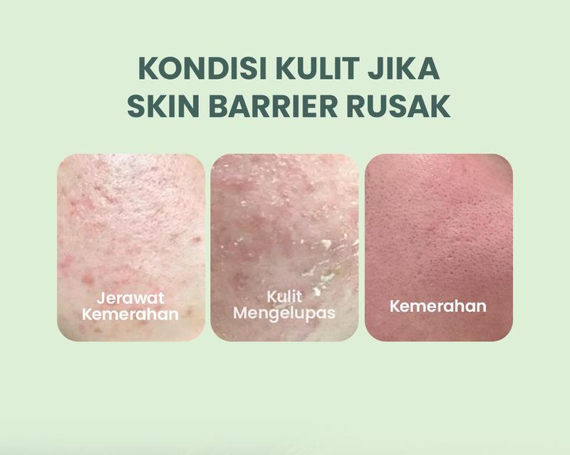 Product Introduction of ✨MJ 100% ORI✨ YOU AcnePlus Multi-Action Skin Cream | Moisturizer Anti Jerawat | Kulit Berminyak | Menghidrasi | Bebas Jerawat Treatment Wajah Berjerawat Perawatan Beruntusan 1