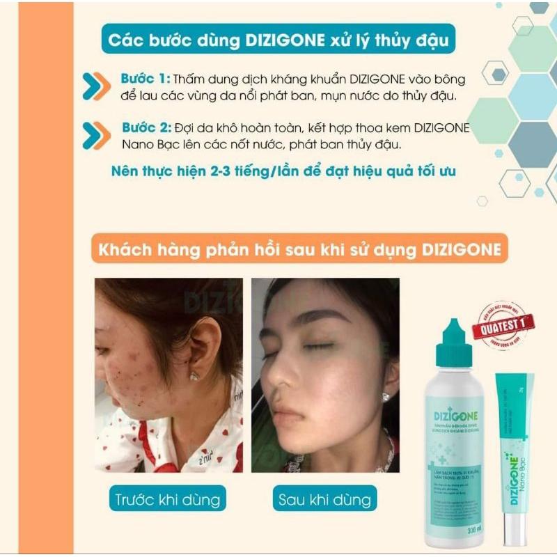 [Mua nhận quà] Kem DIZIGONE NANO BẠC - Kháng khuẩn, lành thương, ngăn ngừa sẹo, phục hồi tổn thương da mạn tính 8