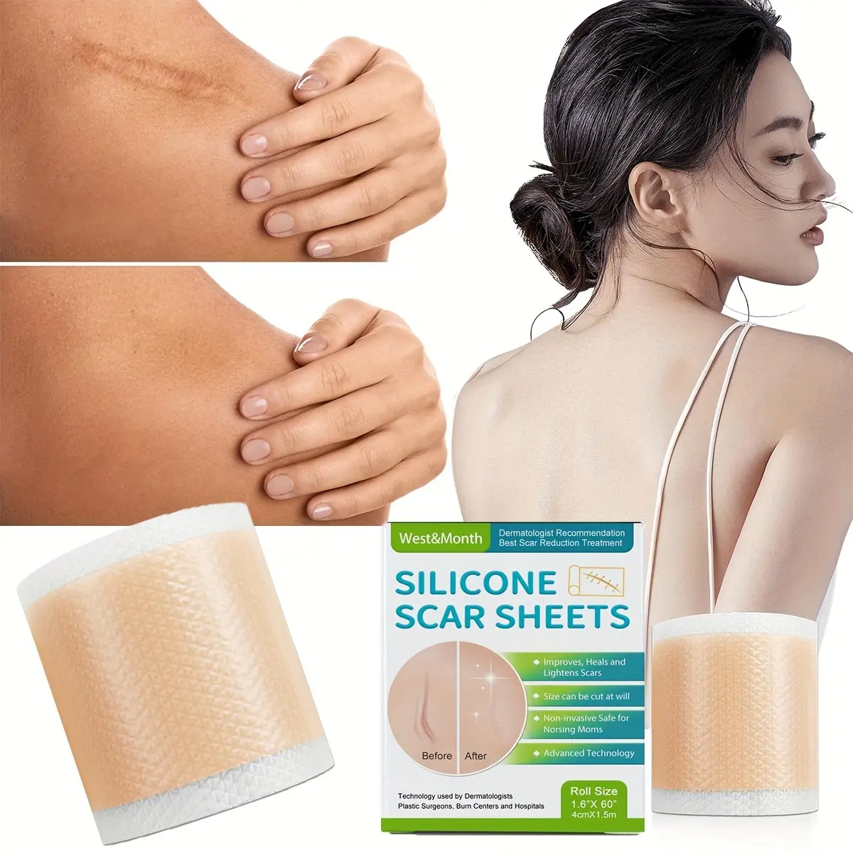 2024 New Self-Adhesive Silicone Scar Patch Sheets, Soft Painless Easy ...