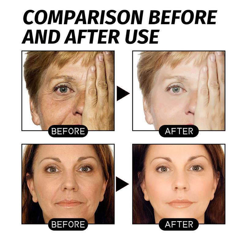 Product Introduction of Eelhoe Retinol Snake Venom Gold Facial Mask Cleansing Skin Firming Pores Brightening Skin Rejuvenating and Hydrating Facial Mask 10