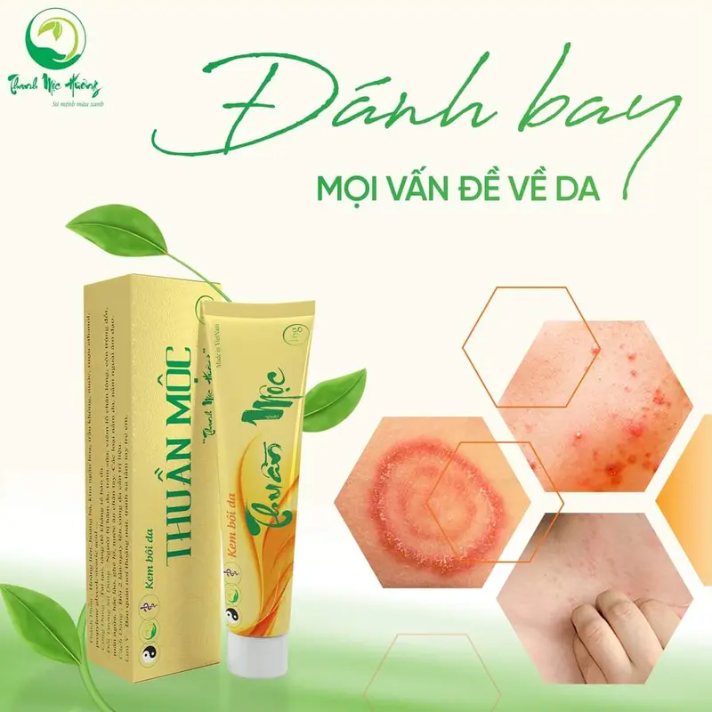 Thuần mộc bôi da kem bôi da thuần mộc nấm ngứa hắc lào Thanh Mộc Hương 1