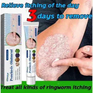Efeknya langsung terasa! Salep khusus untuk psoriasis - impor - kurap di kulit kepala - kaki atlet - kurap di tubuh - eksim - infeksi kulit - obat luar untuk gatal