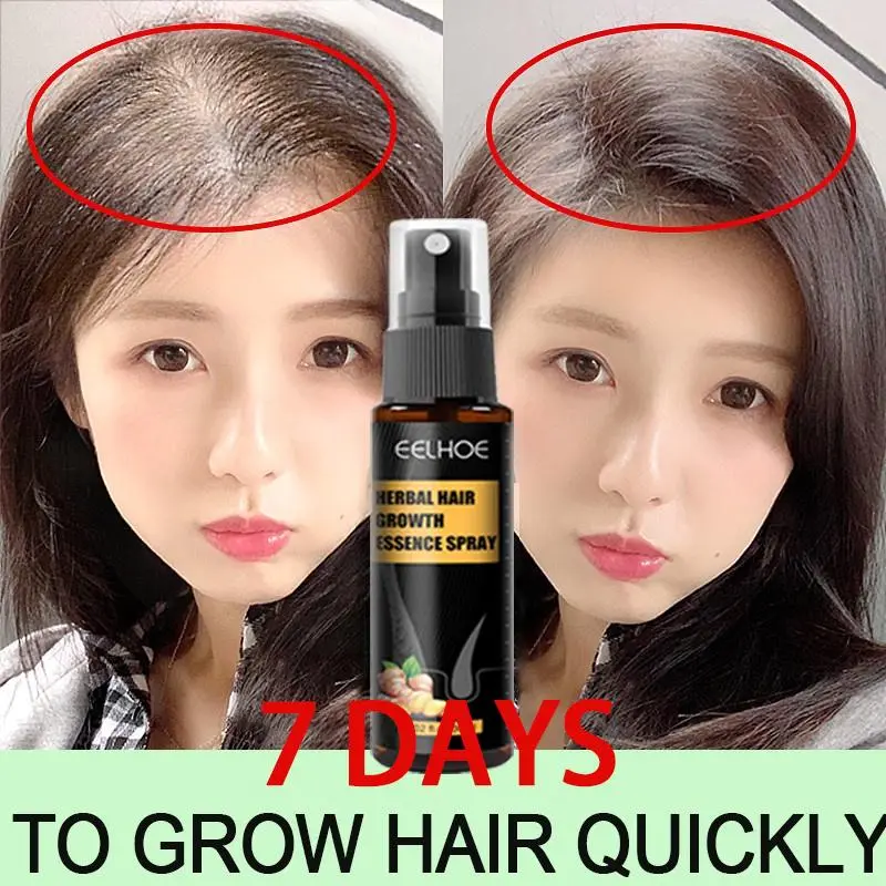 7 Days Fast Hair Growth spray original for women hair grower fast long  hair growth serum 10 x faster hair  for man  new mo hairtech hair growth spray tf009