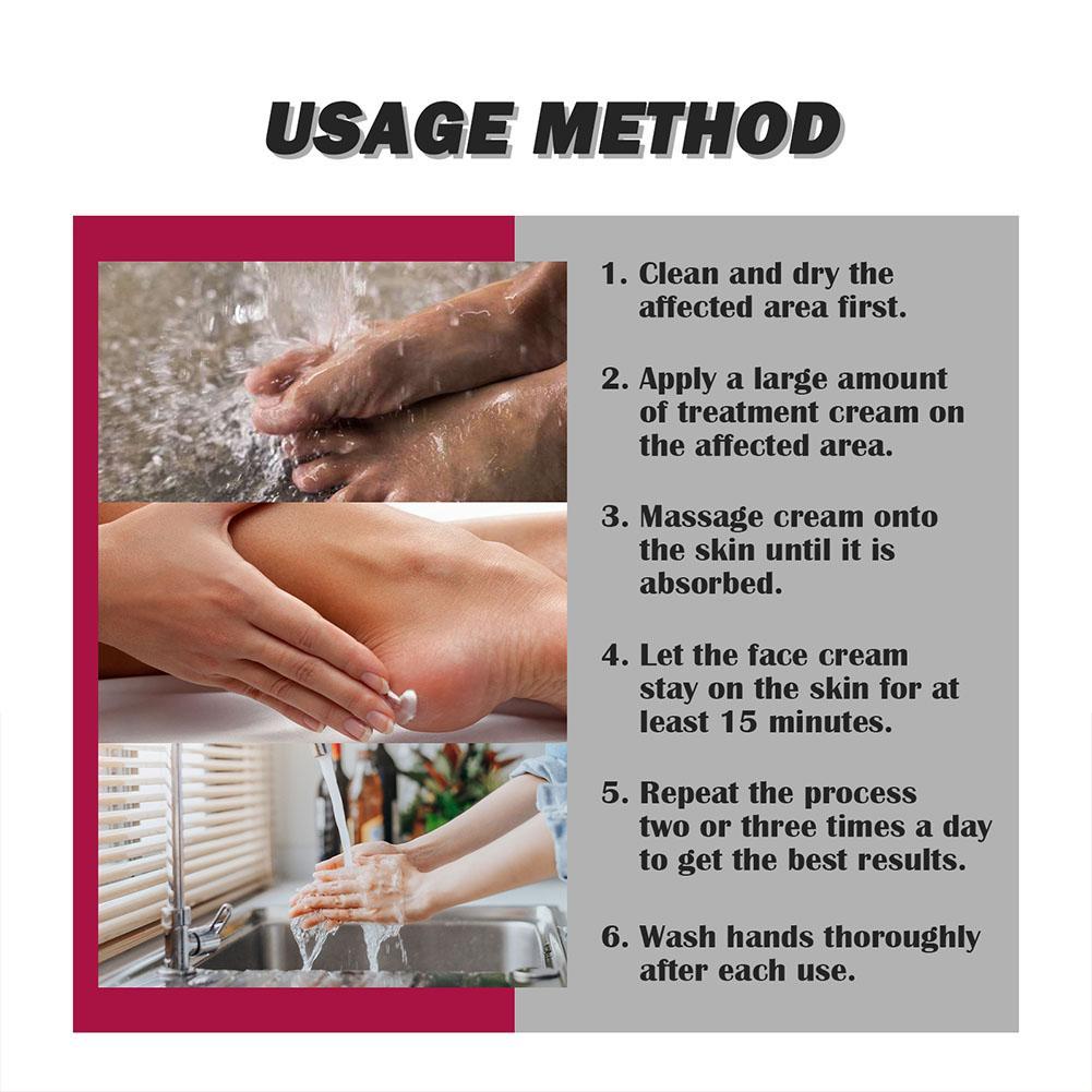 South Moon Joint Bone Therapy Intensive Concentrate Dan Pengobatan Terapi Sendi Krim Pereda Y9R3