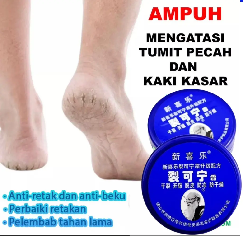 Krim Kaki Pecah Kering Bopak dan Tangan Kapalan Pecah Kasar Kering bolong bolong salep kaki pecah dan kering ampuh salep kaki pecah dan kering ampuh salep kaki pecah pecah dan kering dan kasar