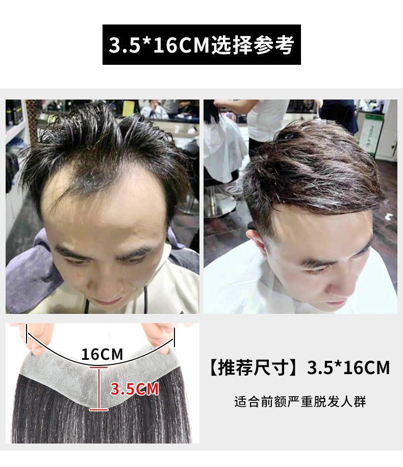 Product Introduction of Hairline fake hair stickers forehead men's high forehead men's baldness wig piece real hair seamless invisible bangs stickers men. 5