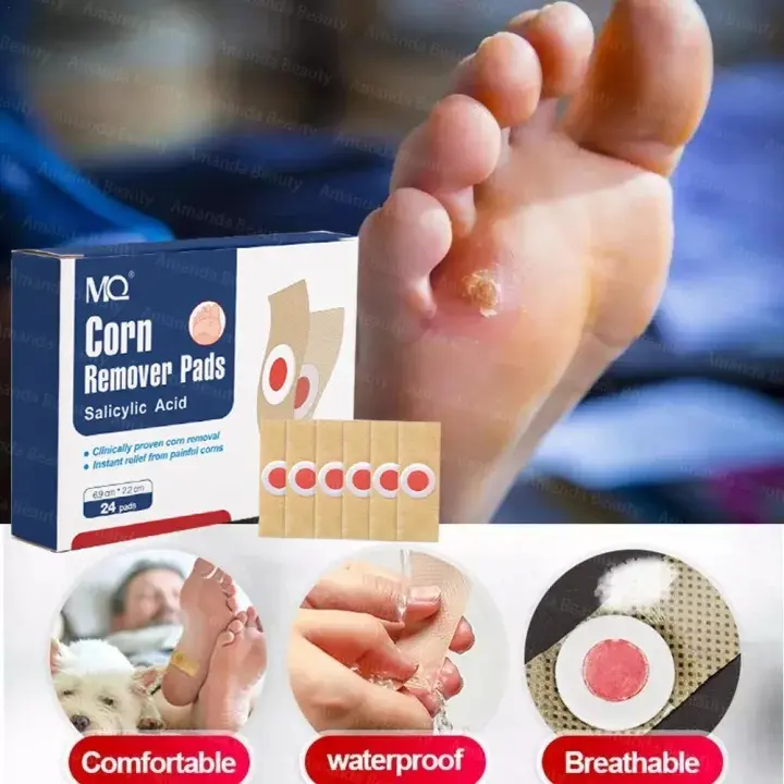 24PCS CORN REMOVAL PATCH - Koyo Kaki Ampuh Plester Penghilang Kutil Kapalan Mata Ikan Kapalan Corn Patch Removal Obat Kutil Kapalan Mata Ikan Kaki/Plester Penghilang Kutil Mata Ikan 4