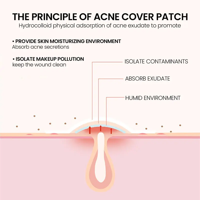 Star Shaped Acne Patches, 5 Sheets/box Hydrocolloid Acne Covering Patches, Facial Skin Care Products for Women & Men 2
